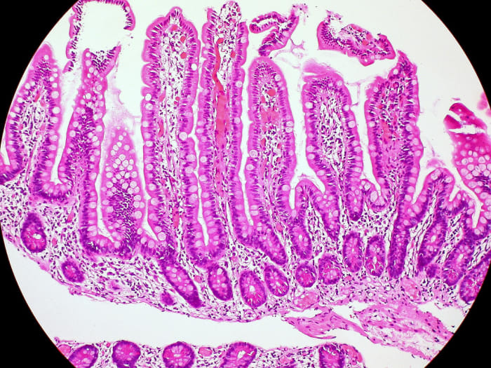 This is part of the mucosa lining the small intestine. The folds are known as villi. They increase the surface area for the absorption of digested food.