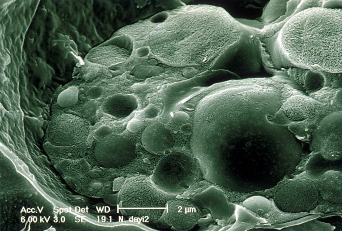 The chytrid fungus could be considered beautiful in this photo obtained via an electron microscope. Its effects are the opposite of beautiful, however.