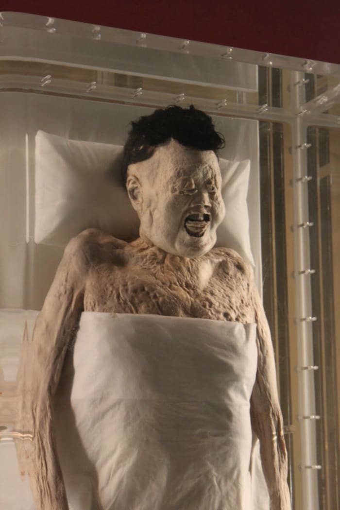 Unlike the mummies of ancient Egypt, this one still has blood in her veins and is soft to the touch.