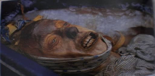 John's nose is actually dark due to the blue wool blanket that was placed over his face by the Franklin crew. The polka-dotted cloth around his head was originally to keep his jaw closed before rigor mortis.
