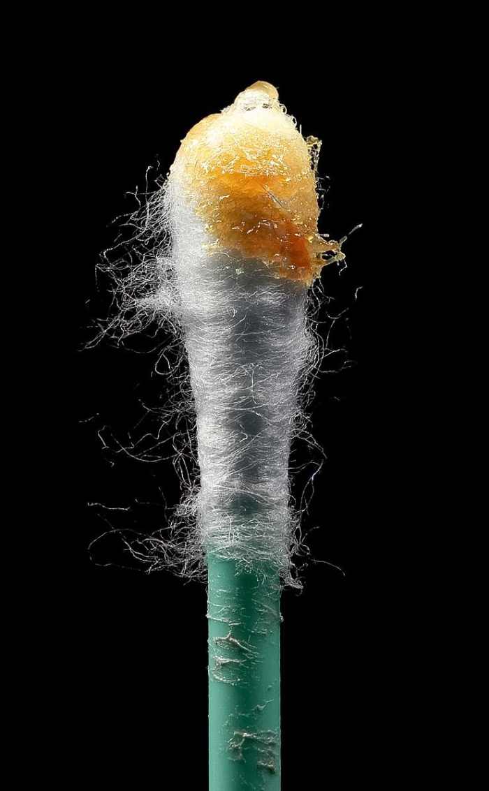 Earwax Facts, Functions, and Potential Health Problems Owlcation