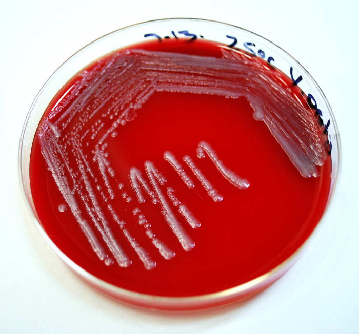 A urine culture is the best way for your vet to determine what is causing your dog's bladder infection.