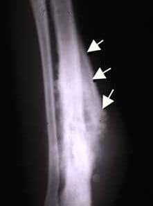 Dog osteosarcoma Codman triangle