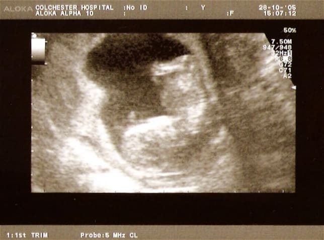 The more money that you can save during pregnancy the more you will have for any little emergency the pops up.