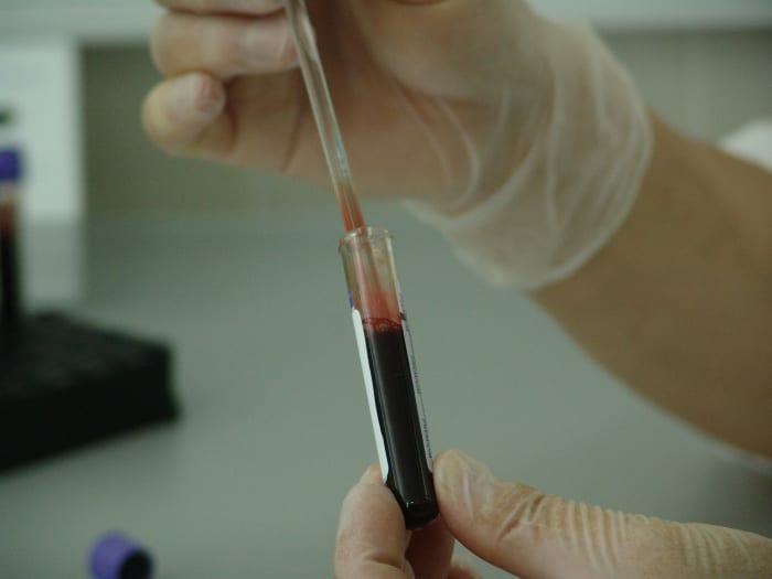 Can you imagine being secretly tested for certain diseases and conditions by your employer? That's what happened to employees in several high profile cases leading up to the passage of GINA.