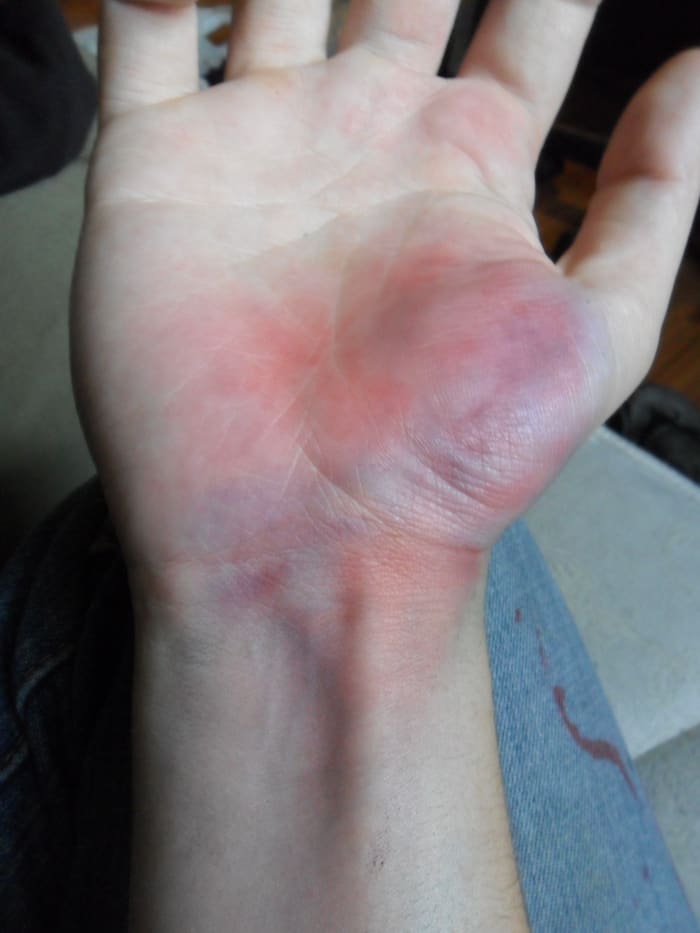 Now that I've added the darker blue to few areas and blended it with my base layers, the overall look of the bruise is more dynamic.
