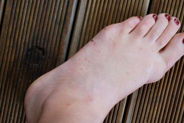 How To Avoid Bed Bugs When You Travel WanderWisdom how-to-avoid-bed-bugs-when-you-travel-wanderwisdom
