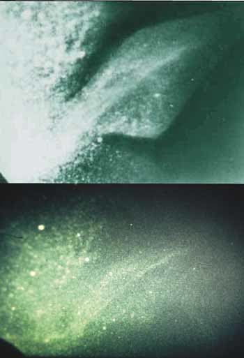 The famous flipper photos...before and after. It turned out they were fakes and were exposed by Shine in 1989