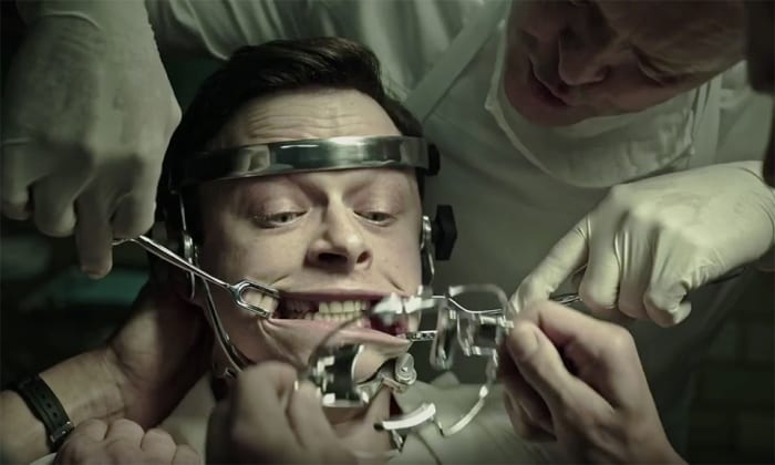 Lockhart has his teeth fixed. You can't be wandering around with missing teeth, what will people think? #DaneDehaan