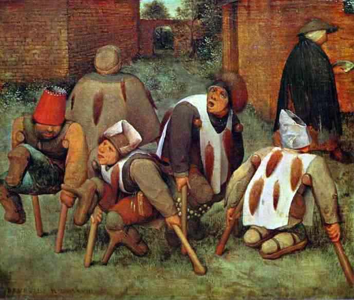 A 16th-century artistic representation of disability.