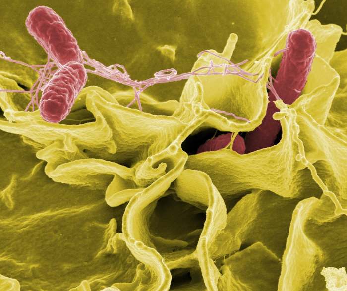 Salmonella bacteria (the red rods) can cause infections; the scene is real, but the colors are false