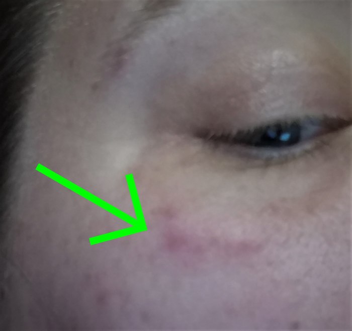 So, I have no idea what I do while I sleep, but I will oftentimes wake up with new bumps and bruises. I like to make up fun stories about fighting ninjas and saving babies from runaway trains.