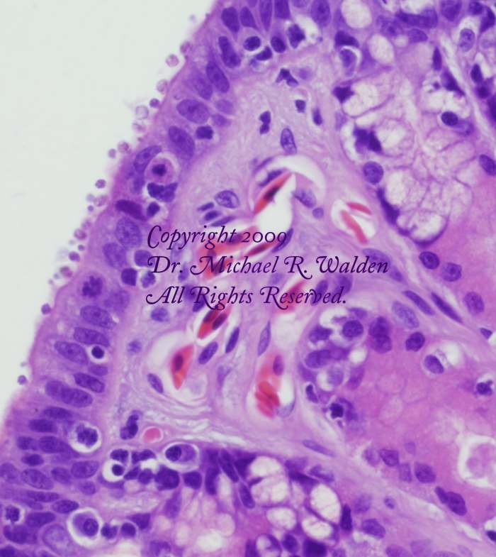 Stomach of Elaphe obsoleta lindheimeri. Coccidia of the genus Cryptosporidium are visible on the surface as small round objects just above the mucosa.