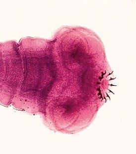 Living Spineless: Types of Invertebrate Animals - HubPages Living Spineless: Types of Invertebrate Animals - HubPages