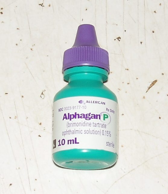 Alphagan is just one of the many different pharmaceutical eye drops used to treat glaucoma.