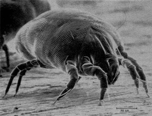 Here is a photo of a house dust mite. The dust mite is microscopic and this photo has been blown up so you can see it.
