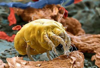 You can with careful cleaning and the other tips above control and eliminate dust mites from your house. But its a long term thing that your going to have to keep doing.