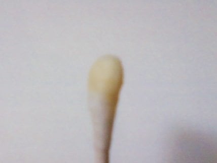 As a gluten-free vegan, I get very little ear wax. This Q-tip, moistened with a little rubbing alcohol, shows the wax from my left ear.