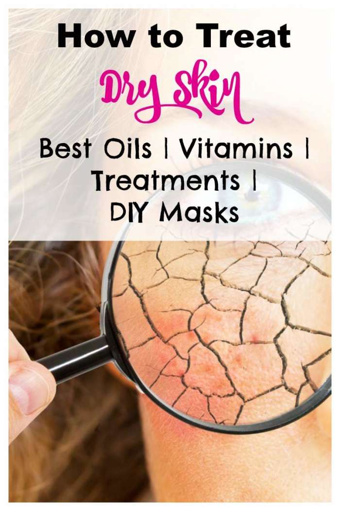 How do you treat dry skin? Keeping the skin moisturized with the right products, natural ingredients and a proper diet