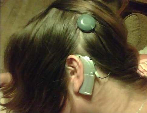 This is me from a cell phone picture. There is the silver Auria. Another useful fact is that this is a BTE (behind-the-ear) product, so named for very obvious reasons.