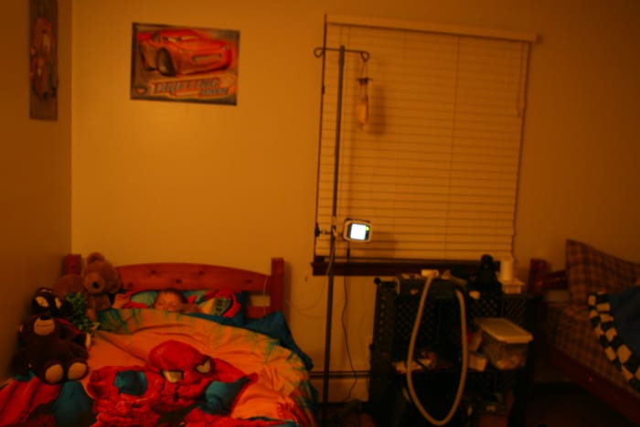 The author's five year old son receives supplemental nutrition overnight via a g-tube.