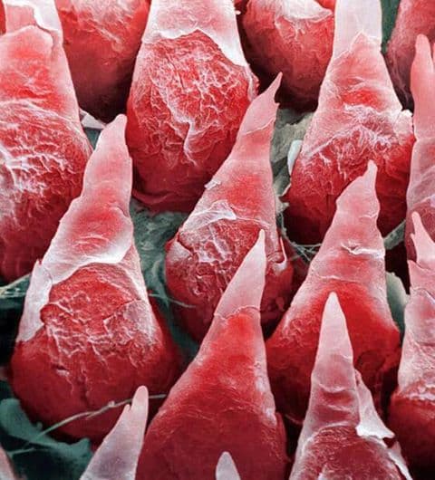 The human tongue is covered with tiny soft spikes called Filiform Papillae