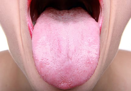 Mucosa is the pink tissue that you can see on your tongue. Your tongue is the only muscle that is not attached at both ends.