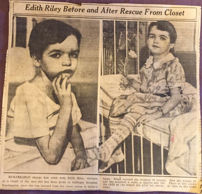 Edith Riley, of Washington State, before and after her rescue from the closet in which her parents imprisoned her.