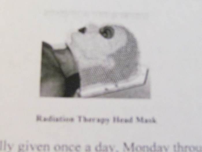 A Radiation Therapy Head Mask. "Patients getting radiation to the head may need a special mask. The mask helps keep the head from moving so that the patient is in the exact same position for each treatment."