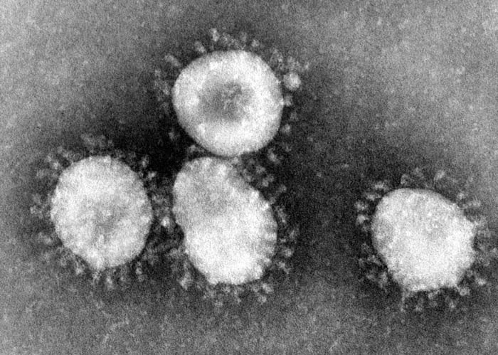 Coronaviruses as seen under a microscope. They are called "corona" because the spikes on them make them look like a crown which is "corona" in Spanish.