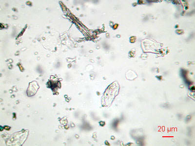 This is what "dust" looks like under a microscope. Busy looking stuff, isn't it? (source: funsci.com)
