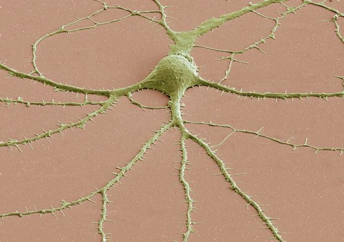 Photomicrograph of a neuron’s cell body (top, center) and its dendrites radiating out of it, obtained with a scanning electron microscope.