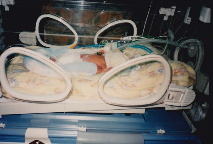 The blue U shape around her legs is a rolled up blanket that helped her to feel contained and safer. She cried less with it there than without.