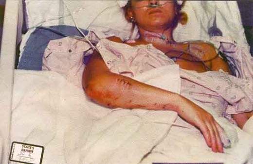 Self-inflicted? In hospital photo. Main artery barely missed in her neck. Two jurors swear they never saw these photos.