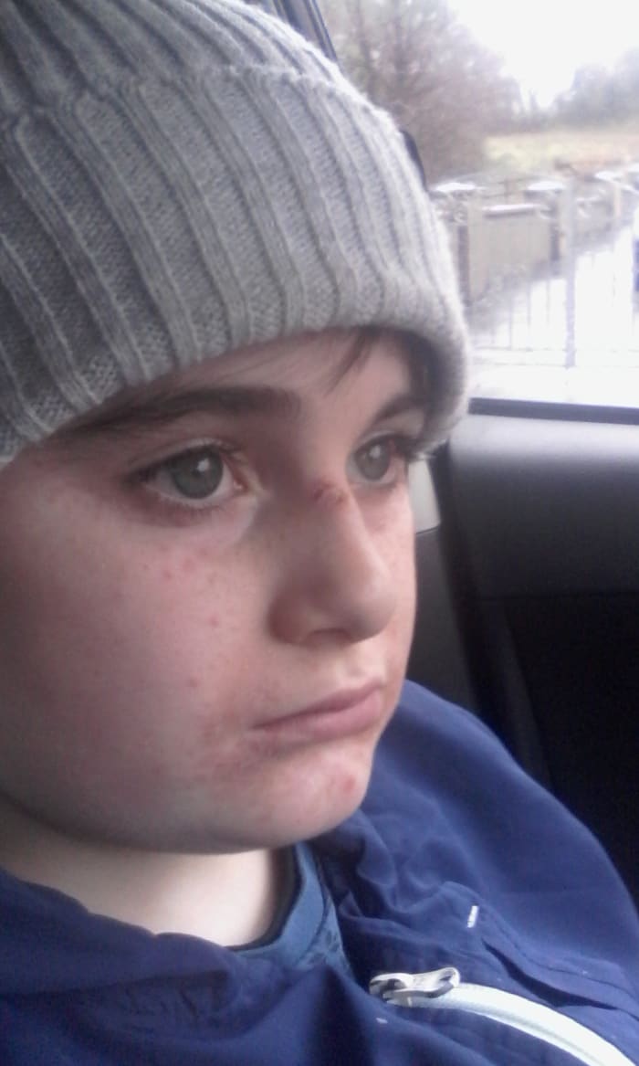 Adam beginning his journey to see Dr. Krigsman, in Sofia, Bulgaria,after years of being in pain. Our children need to be heard