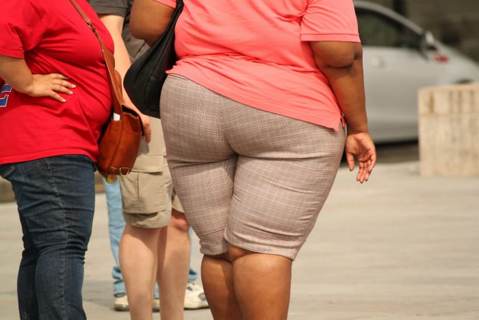This is what an obese or overweight person looks like which is caused by a variety of factors including bad dietary choices & a lack of exercise.