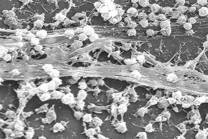 This is a biofilm created by Staphylococcus bacteria on a catheter. The fibrous slime connects bacterial cells together.