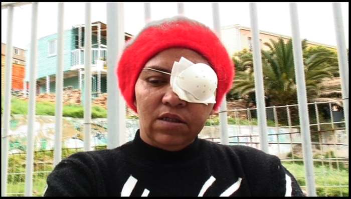 Another victim who lost an eyes, Auriol Cloete, and told of other four people whom the police had taken they eyes from them and apparently these people did nothing to suffer such a costly fate
