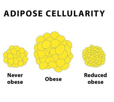 And example of fat cells. Notice how, after obese, the number of cells remains high. However, by shrinking the fat cells, they can take up just a little space as the never obese example.