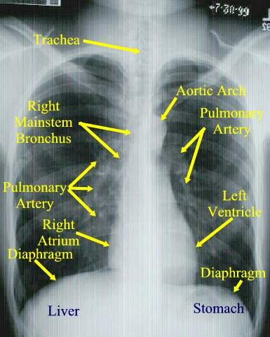 Tobacco smoke has over 40 carcinogens that can affect the respiratory system (larynx and bronchus) and urogenital system (bladder, kidney and cervix).