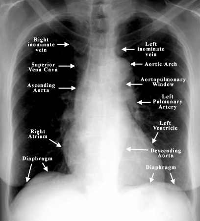 Another pharmacologica strategy could be Bupropion tablets: mode of action in smoking cessation is not clear.