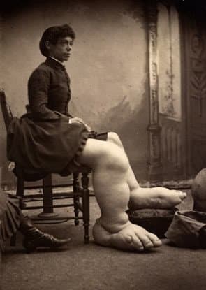 Born with a beautiful face and giant feet, Fanny Mills came with a dowry of five thousand cash and a “well stocked farm” in Ohio from her desperate father, to any single men willing to take her as bride.
