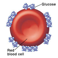 Diabetics red blood cells have more glucose molecules attached to them when glucose level are high. This is what H1Ac test measures.