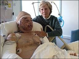 Jim Hamm in 2007, hospitalized after cougar attack. (Thank you for the use of your famous image, Mark!)