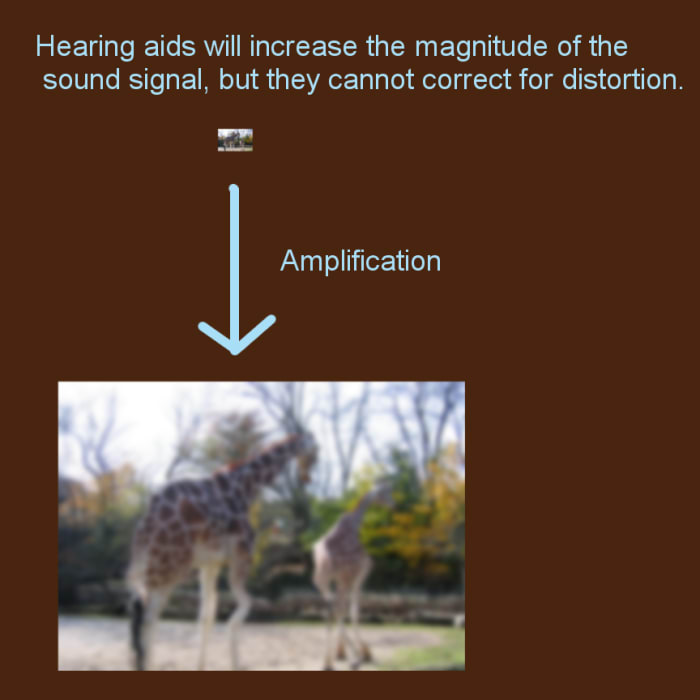 Hearing aids will make sound louder, but they cannot correct distortion caused by damaged cochlear hair cells (click to enlarge).