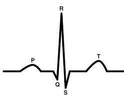 The pattern of an electrocardiogram of a human has more peaks before and after the major peak.