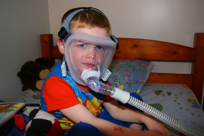 The FitLife full-face mask is great for kids with congestion or who have sensory issues with the nasal mask.
