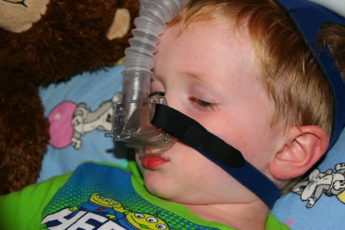 The Child Lite mask is quiet, but poorly secured. In addition, the tubing is held in a rigid position on the child's forehead.