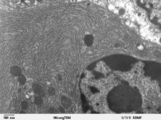 Endoplasmic reticulum are usually found around the nucleus. If you look closely you can see the tiny ribosomes studding the surface, making this Rough ER