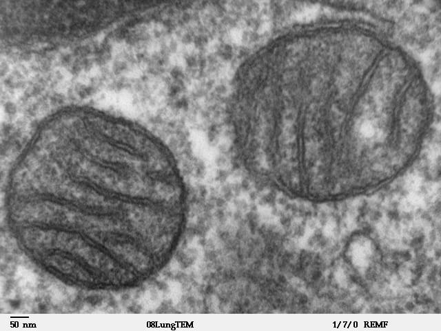 The power houses of the cell are easy to identify - just look for wavy lines in the middle of a dark circle. This is the double membrane of the mitochondria